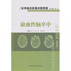 缺血性脑卒中
