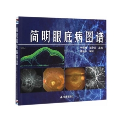 简明眼底病图谱